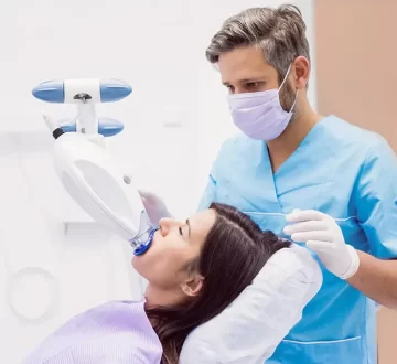 Why Is Professional Teeth Whitening Essential?