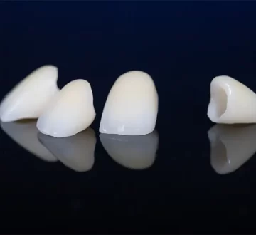 What To Know before Getting A Dental Crown?