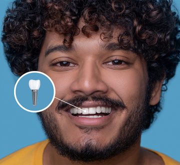 Top Questions to Ask Your Implant Dentist in Billerica, MA Before Treatment