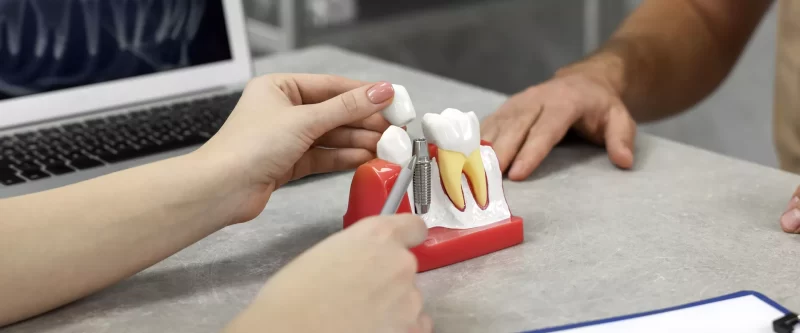 $300 Off Dental Implants 