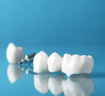 Why Choose a Local Dentist in Billerica for Dental Crowns?